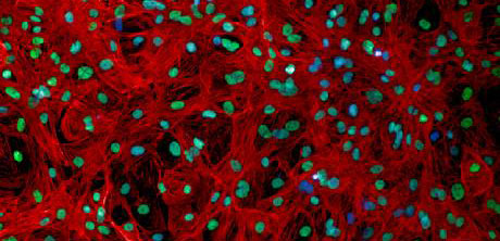 Menschliche Herzmuskelzellen