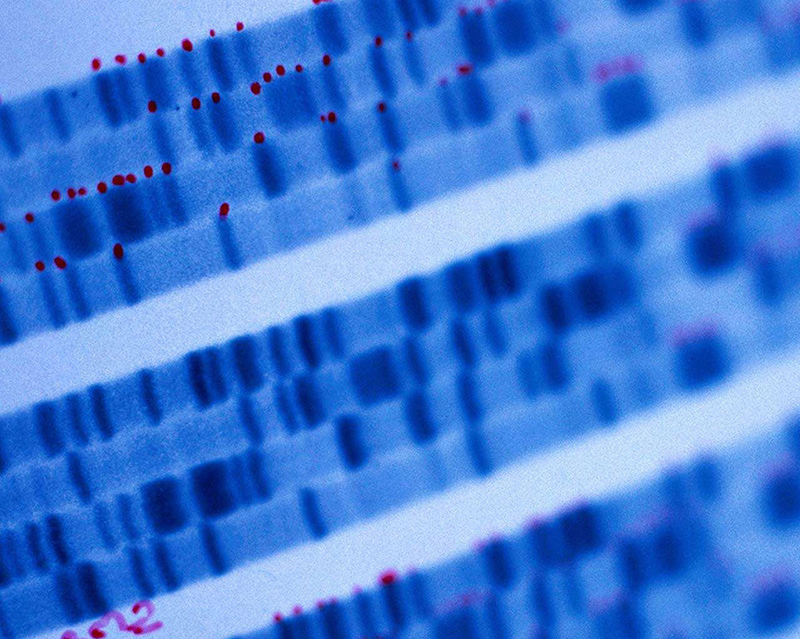 Amgen-Tochter deCode Genetics, Reykjavik, Island