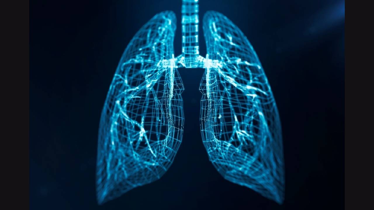 Schematische Darstellung der Lunge mit Bronchialsystem zur Illustration des kleinzelligen Lungenkarzinoms (SCLC).